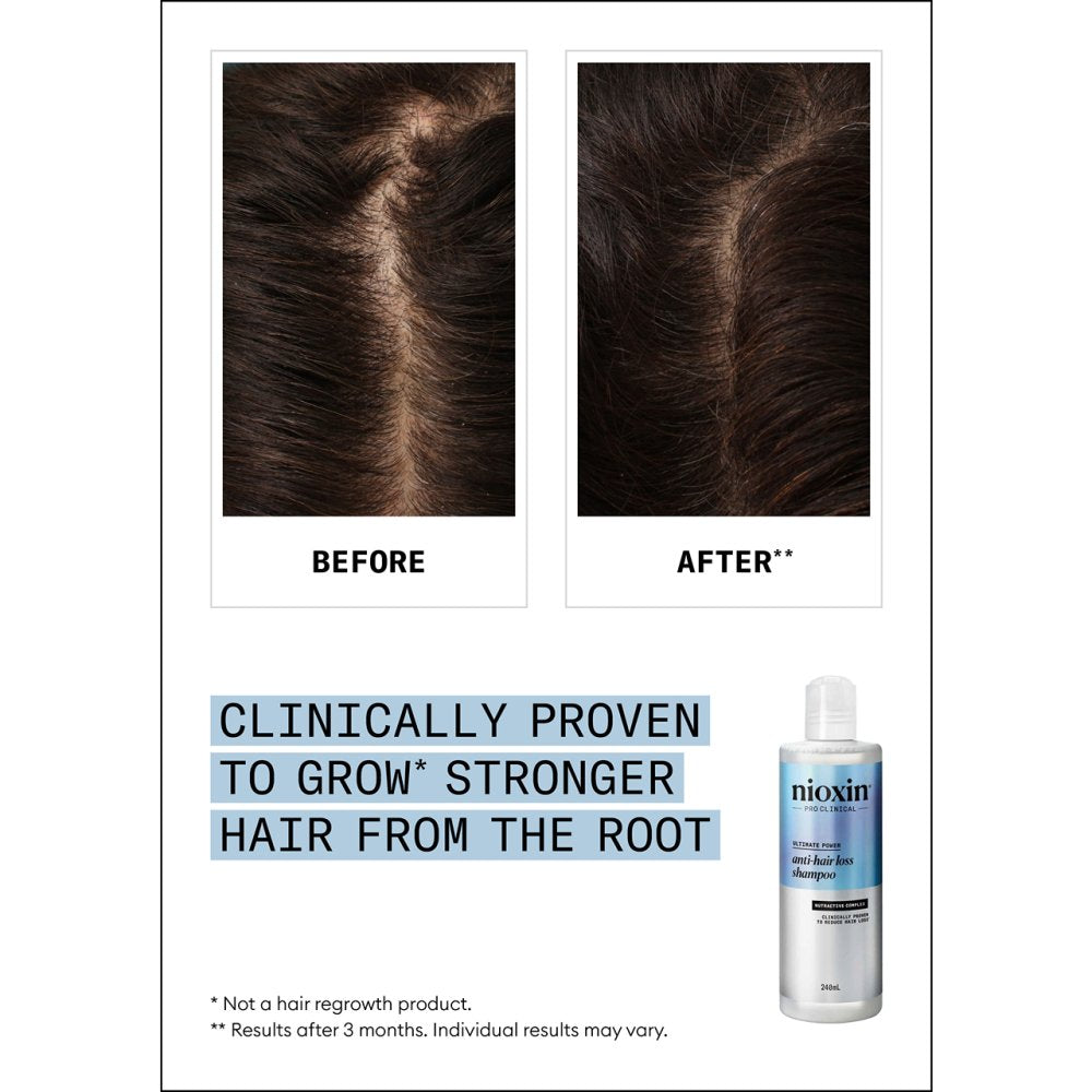 Nioxin anti-hairloss shampoo 240ml Nak Health and Beauty