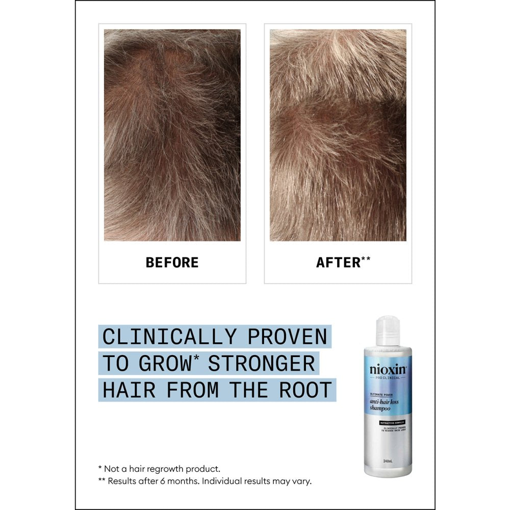 Nioxin anti-hairloss shampoo 240ml Nak Health and Beauty