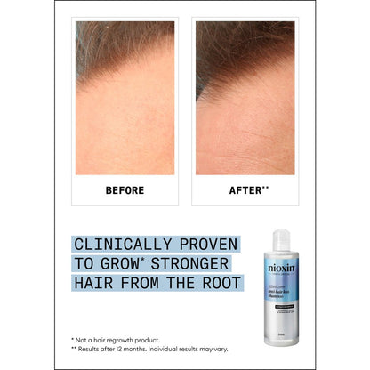 Nioxin anti-hairloss shampoo 240ml Nak Health and Beauty